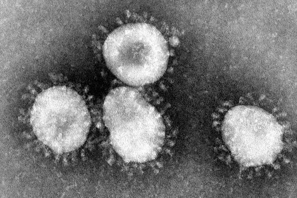 Коронавирусы под микроскопом. Фото: CDC / Фред Мерфи